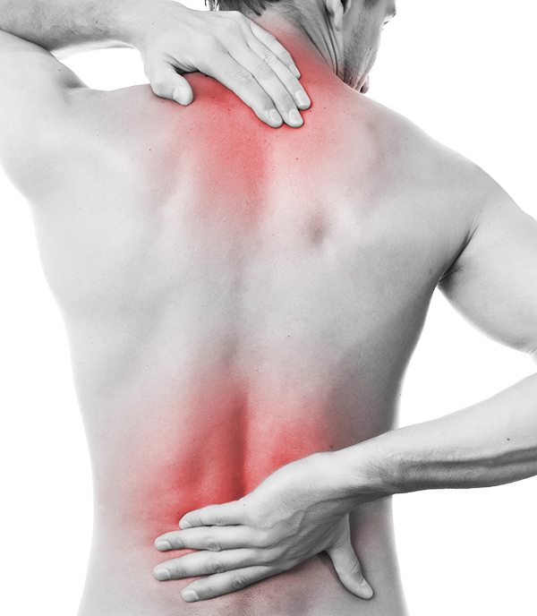 Rückenschmerzen durch verspannte Muskeln und Faszien